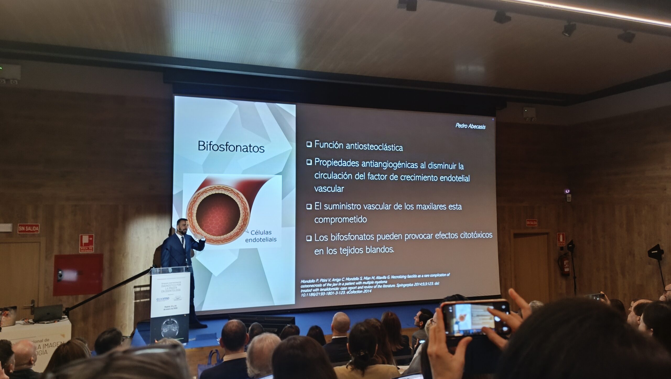 Simposio Internacional de Diagnóstico por la Imagen en Odontología: osteonecrosis medicamentosa y reducción del ruido anatómico