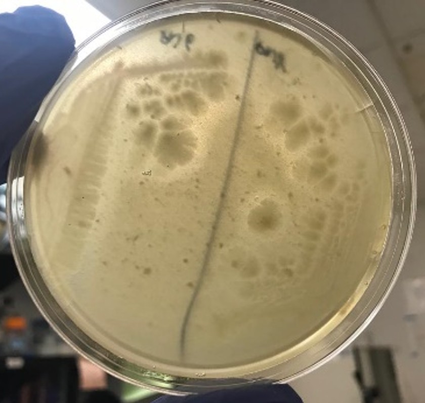 Las bacterias de la saliva pueden ayudar a reducir las reacciones alérgicas al cacahuete