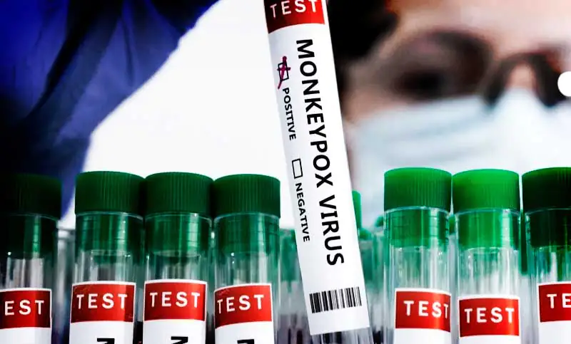 Sucre: Emiten alerta epidemiológica por primer caso de viruela del mono